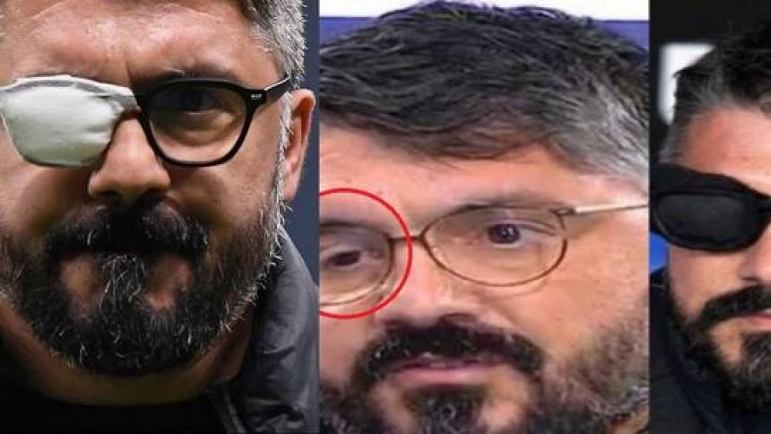 غاتوزو يؤكد معاناته من مرض نادر و وسائل إعلام زعمت أنه سيموت بعد شهر